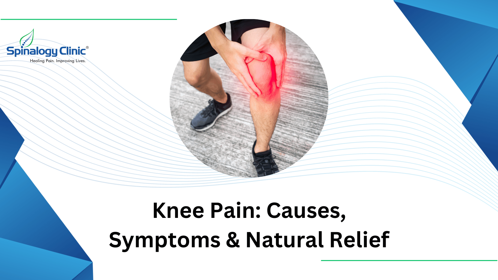 Knee Pain: Causes, Symptoms And Natural Relief